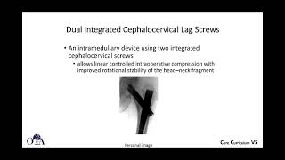 Intertrochanteric femur fractures  3 of 3 [upl. by August]