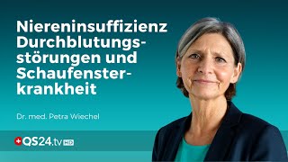 Niereninsuffizienz Durchblutungsstörungen und Schaufensterkrankheit  Dr med Petra Wiechel  QS24 [upl. by Aneet]