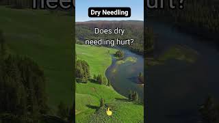 Does dry needling hurt [upl. by Franni]