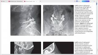 SPINE IMAGING DIAGNOSTIC IMAGING SERIES [upl. by Choong]