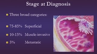 Bladder Cancer [upl. by Eirellam314]