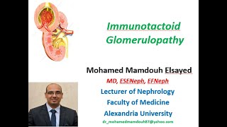 Immunotactoid Glomerulopathy [upl. by Anilev]