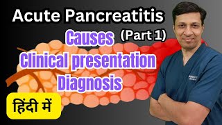 Acute Pancreatitis एक गंभीर बीमारी Acute Pancreatitis in hindi [upl. by Yrelle]