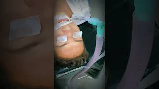 General Anesthesia Intubated Patient Views Before Surgery Shorts [upl. by Natsirc475]