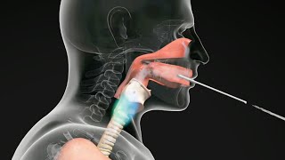 How do Straw Exercises Help the Voice Get Better voicetherapy [upl. by Wengert]