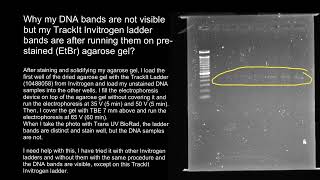 Gel electrophoresis faint bands [upl. by Nyrol]