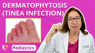 Dermatophytosis Tinea Infection Integumentary System  Pediatric Nursing  LevelUpRN [upl. by Harim234]