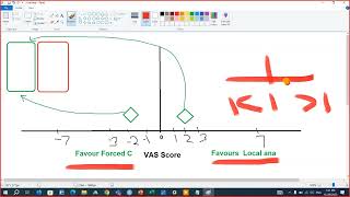 Position of Intervention and Control On MetaAnalysis Forest Plot [upl. by Odnomar229]