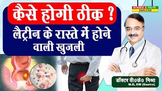 कैसे होगी ठीक लैटिन के रास्ते में होने वाली खुजली hemorrhoids [upl. by Eissalc630]