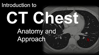 Introduction to CT Chest  Anatomy and Approach [upl. by Latvina]