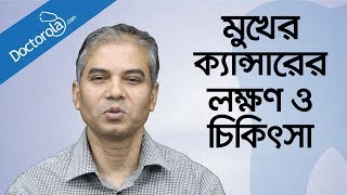 মুখের ক্যান্সারের চিকিৎসা Mouth cancer symptoms amp treatment in banglabangla health tips [upl. by Salina]