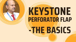 The Keystone perforator flap Basics [upl. by Aeila]