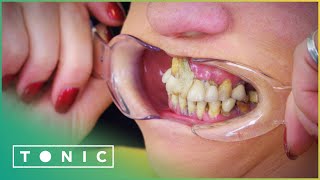 Woman Glues Her Teeth Back In Place To Avoid The Dentist  The Truth About Your Teeth  Tonic [upl. by Adolpho]