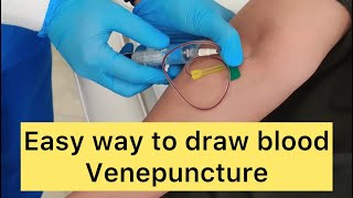 How to draw blood Venepuncture Blood sample for PRP Platelet rich plasma venepuncture blooddraw [upl. by Kopple]