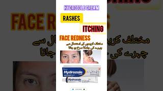 redness fungus redfaceallergy hydrozolepharmacyknowledge treatment [upl. by Aon569]