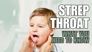 Strep Throat in Kids Symptoms and Treatment by Pediatrician [upl. by Mable]