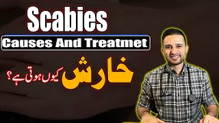 Scabies Ki Pehchan Aur Iska Ilaj \ Dr Shoaib Ke Sath \ The Medbros \ خارش کا علاج [upl. by Assenat]