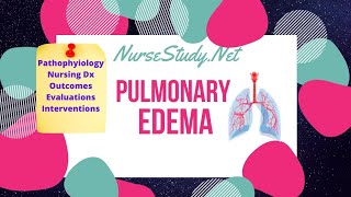 Pulmonary Edema Pathophysiology Care Plan for Nursing Students [upl. by Irtemed]