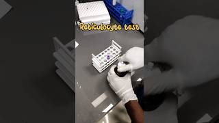 Reticulocyte count 🧑‍🔬🔬 medical lab Reticulocytecount youtubeshorts mbbs shortsmedicallabtech [upl. by Crescen]