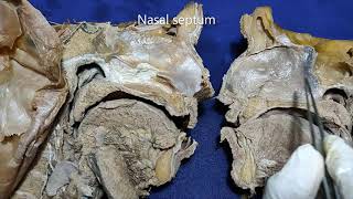 Nasal cavity and paranasal air sinuses [upl. by Ginder]