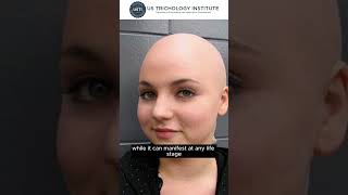 Alopecia Universalis The complete loss of hair on the entire body [upl. by Nitsug488]