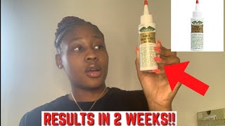 WILD GROWTH HAIR OIL  FAST RESULTS [upl. by Itirahc441]