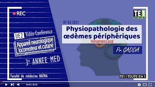 PHYSIOPATHOLOGIE  Physiopathologie des œdèmes périphériques [upl. by Carmela377]