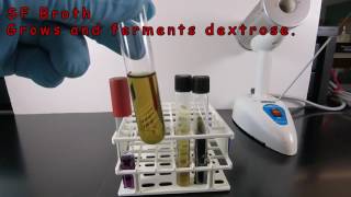 Using SF Broth and Bile Esculin Agar to Identify Enterococcus [upl. by Odranar]