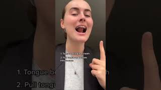 Day 1490 Mewing Results  Get Faster Result  Hindi [upl. by Gabrielle]