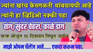 3 दिवसात वांग काळे डाग यावर घरेलु उपाय  स्वागत तोडकर  Swagat Todkar Vang upay [upl. by Acinorahs92]