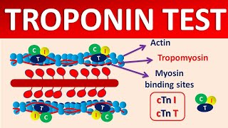 Troponin test and its significance [upl. by Paulo]