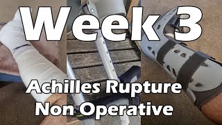 Achilles Rupture Recovery  Week 3  Non Surgical [upl. by Ayotahc]