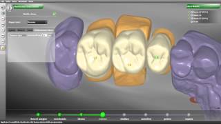 88Scan lo scanner dentale made in Italy by 88Dent [upl. by Veta]