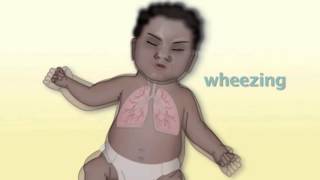 Common Pediatric Respiratory Problems by M Kleinman  OPENPediatrics [upl. by Grieve]