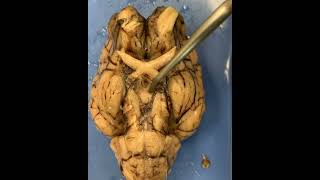 Brain Dissection  Inferior Surface Structures [upl. by Ebbarta685]