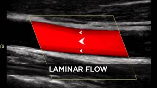 Introduction to Doppler Ultrasound [upl. by Battiste]