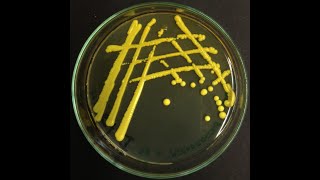 Micrococcus luteus  the most common cleanroom bacterium [upl. by Chrystal]