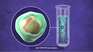 What is the TSPOTTB test [upl. by Inneg]