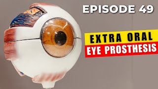 Fabrication of Ocular Prosthesis Artificial Eye 4 Steps  Dr Vikas Gupta [upl. by Waldo]