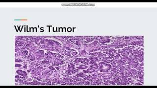 Wilms Tumor [upl. by Runck285]