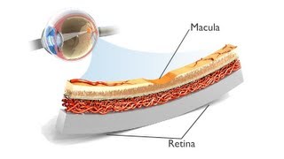 La Degenerazione Maculare Legata allEtà AMD ANIMAZIONE [upl. by Rovner745]