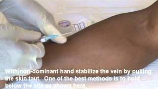 IV Insertion Video Demo 1 of 2mp4 [upl. by Halilad371]