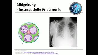 Teil 2  Pneumonie [upl. by Bilac]