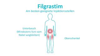 Subkuatane verabreichung von Filgrastim [upl. by Htebazileharas]