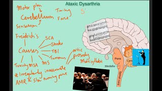 Ataxic dysarthria  samples and explanation [upl. by Shanon]