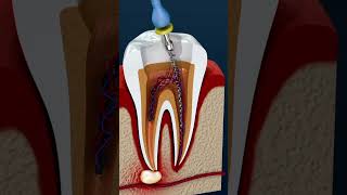 Cavity filling dentist teeth anatomy neet usmlestep [upl. by Anirba]