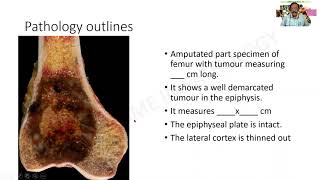 Osteoclastoma  GAME 20  Dr G Shivashekar  SRM  Pathology MBBS practical  University Questions [upl. by Moynahan]