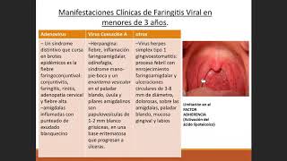 Pediatría  Faringoamigdalitis Aguda y Laringotraqueitis 11 [upl. by Atirihs762]