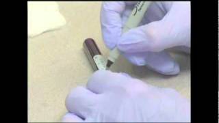 Abbott ARCHITECT HIV AgAb Combination test [upl. by Fine995]