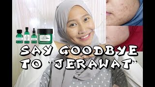 MY ACNE STORY  CARA MENGHILANGKAN JERAWAT DAN BRUNTUSAN PAKE PRODUK ALAMI 1 TEA TREE THE BODY SHOP [upl. by Donella]